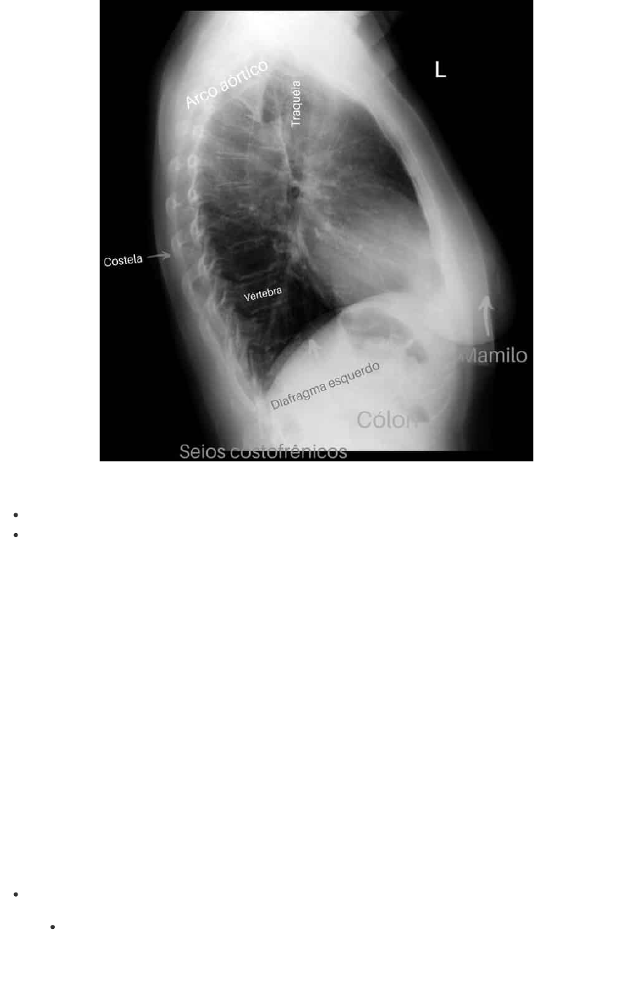 Ressonância Magnética do Pescoço/Coluna : r/chiari, image size:902x1397