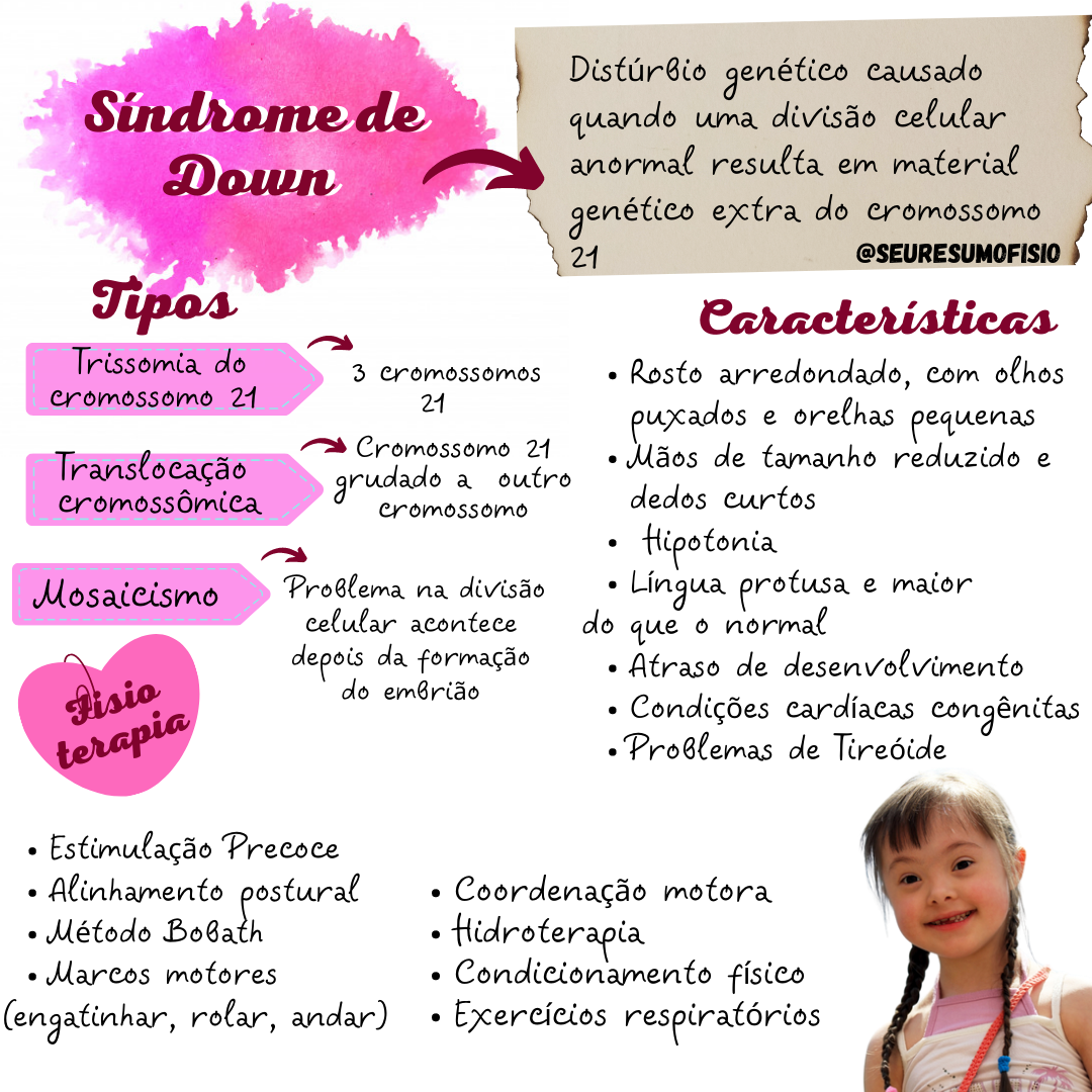 Sindrome De Down Mapa Mental De Pediatria Sindrome De Down Sindrome ...