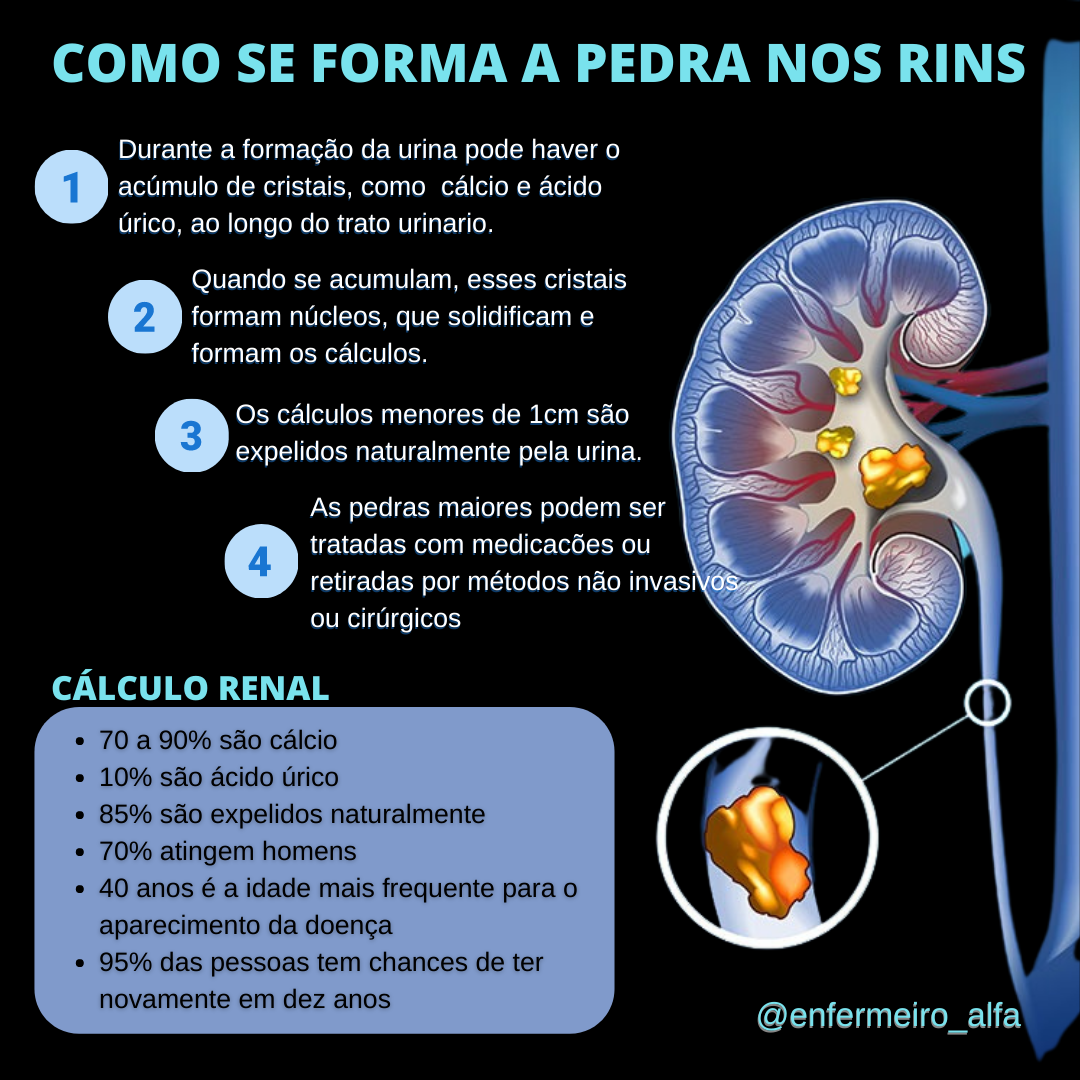 COMO SE FORMA A PEDRA NOS RINS - Enfermagem