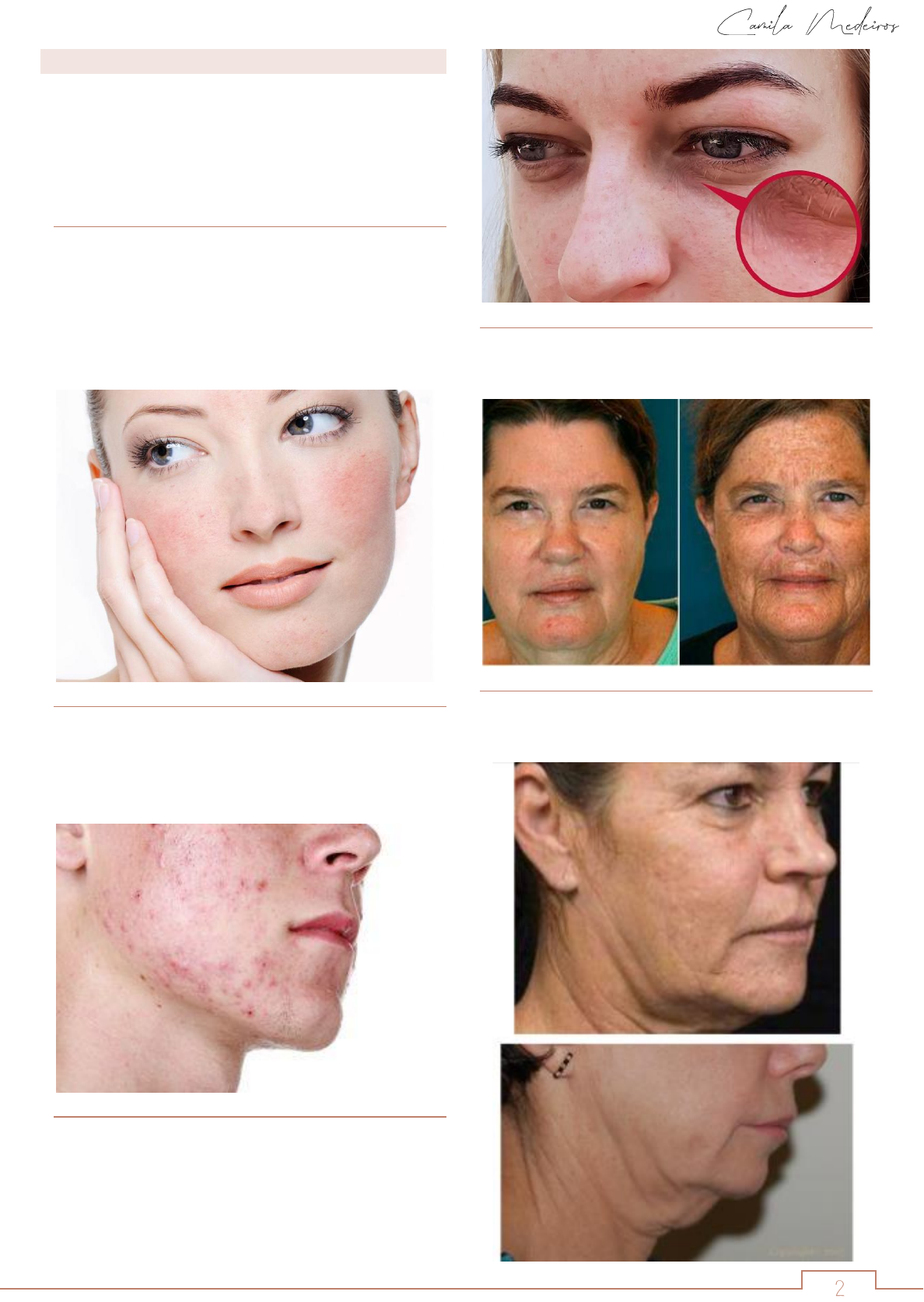 Biotipos cutâneos (pele mista, pele acneica, pele oleosa, pele seca e  outras) - Estéticas - Estética