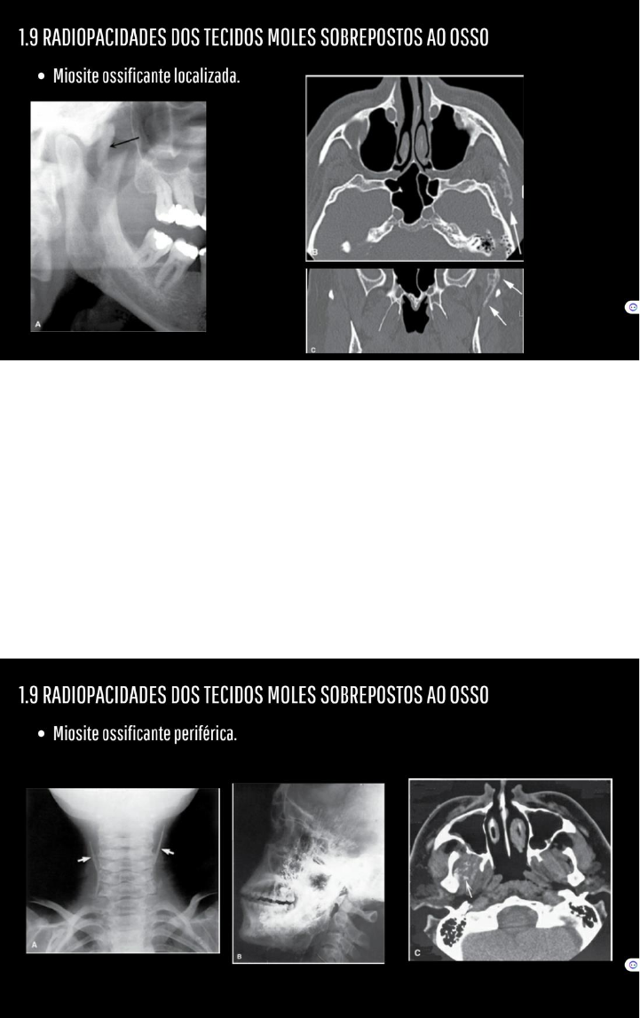Grátis: Lesões Radiopacas - Material Claro e Objetivo em PDF para Estudo  Rápido, image size:721x1147