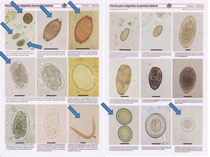 Atlas Parasitologia 1 Parasitologia Clínica