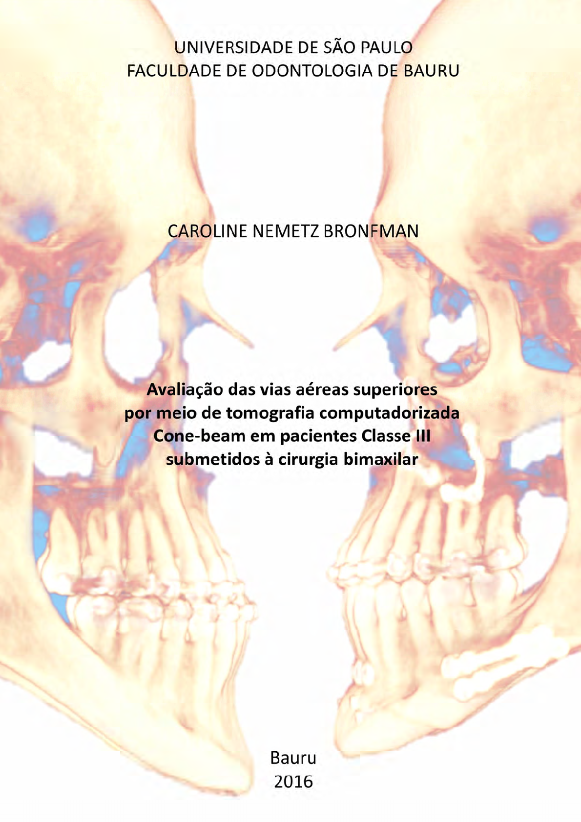 Avaliação das vias aéreas superiores por meio de tomografia computadorizada  Cone-beam - Clínica Médica I