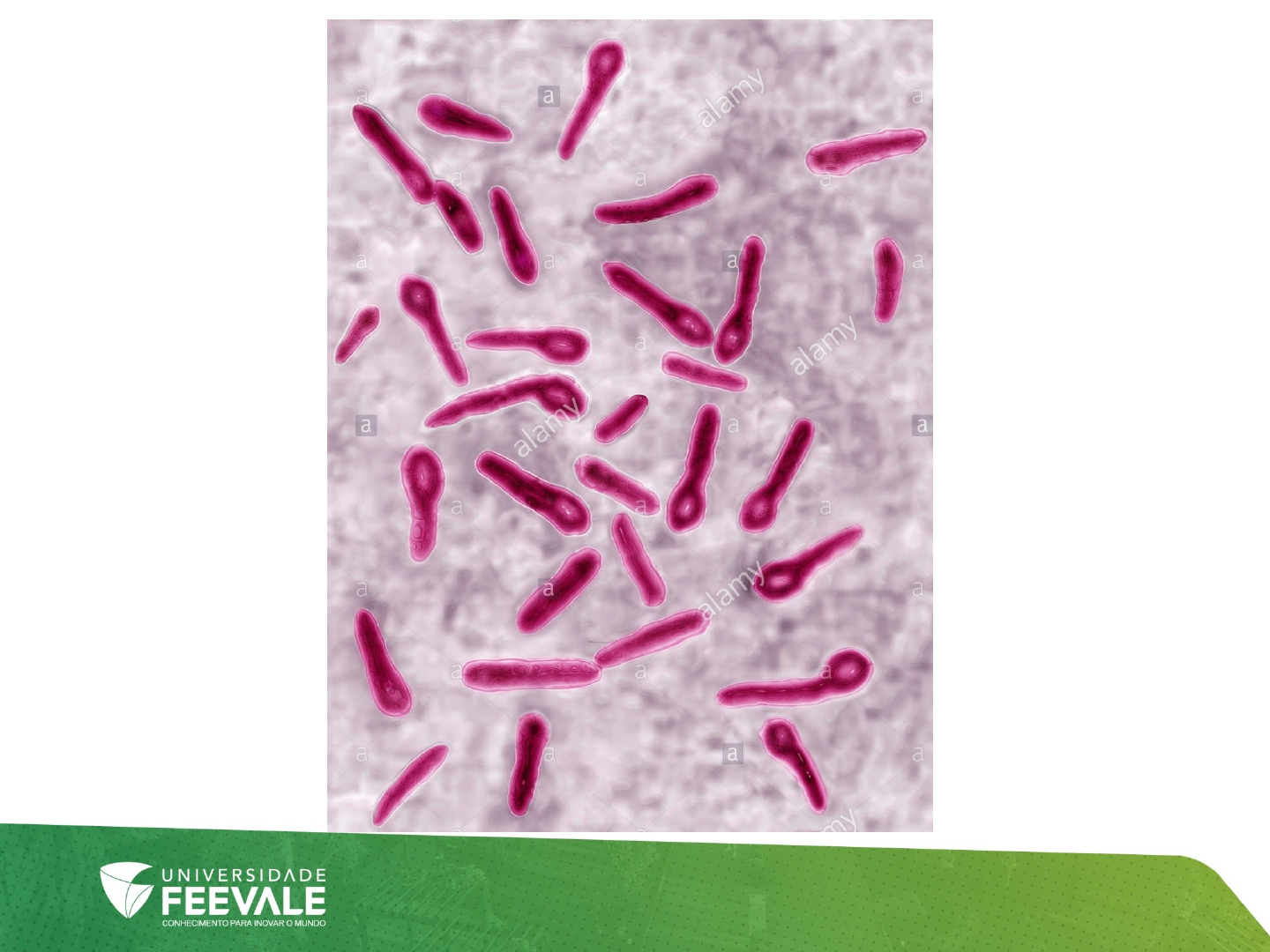 Grátis: Clostridium tetani - Microbiologia - Material Claro e Objetivo em  PDF para Estudo Rápido, image size:1440x1080