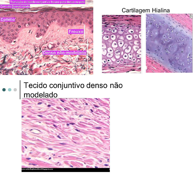 Tecido Conjuntivo Histologia I