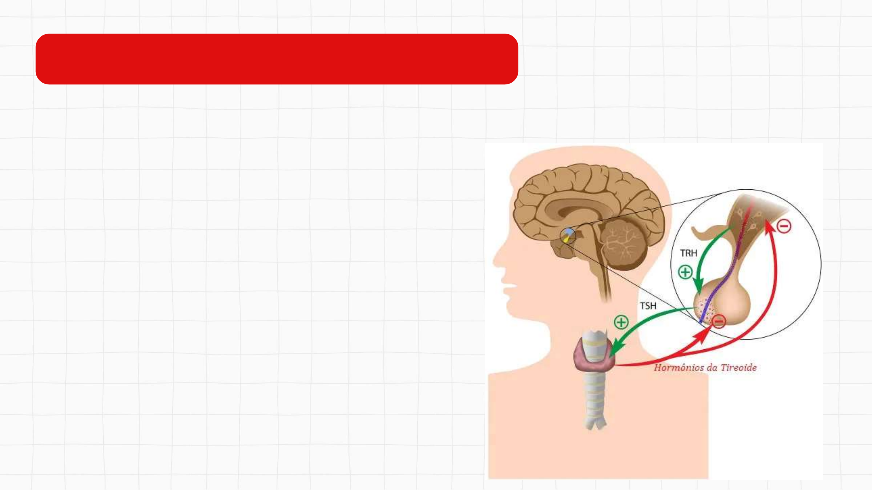 Tireoidite de Haschimoto | PDF | Tireoide | Apoptose, image size:2880x1620