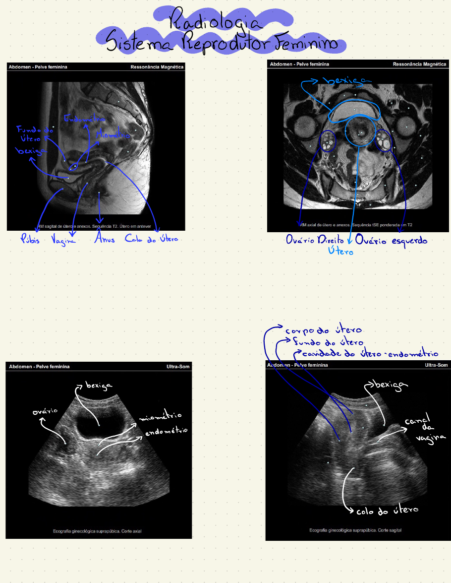 Radiologia Sistema Reprodutor Feminino Radiologia