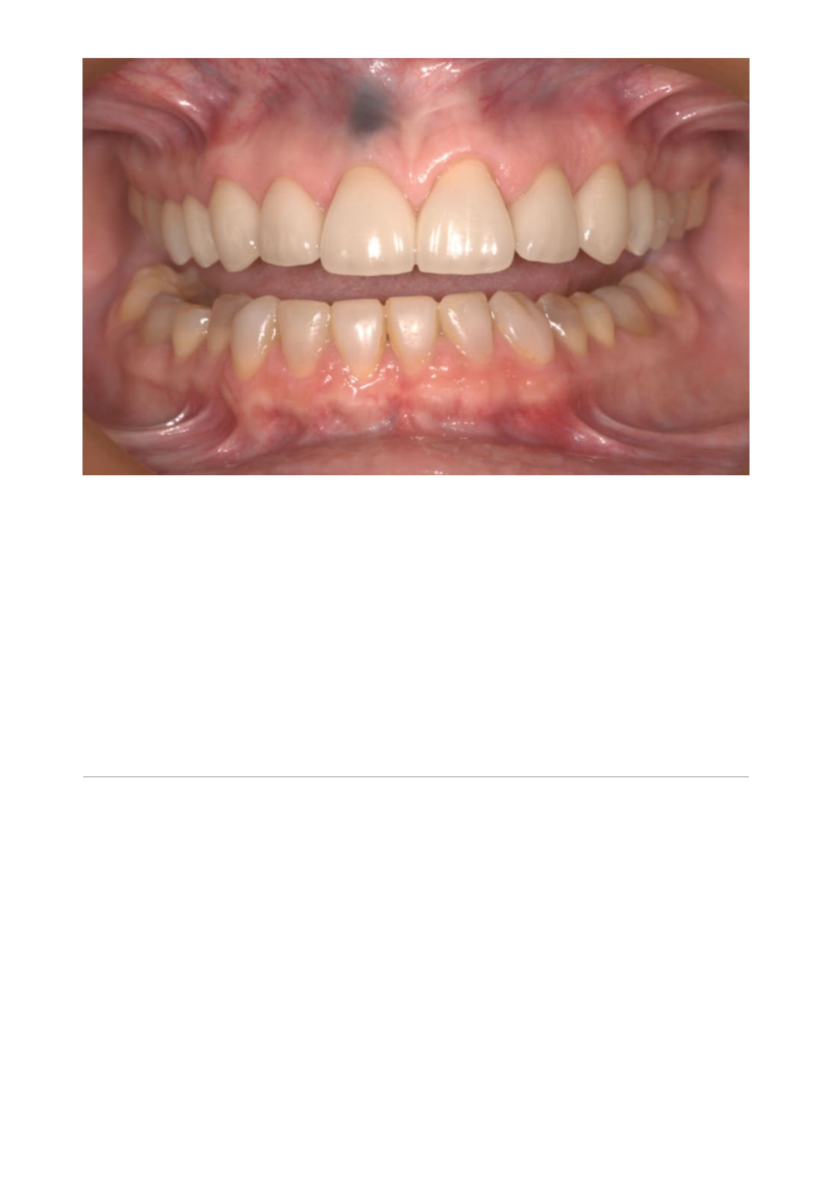 Grátis: 15 Problemas de saúde bucal mais comum e como tratar - Material  Claro e Objetivo em PDF para Estudo Rápido, image size:1190x1684