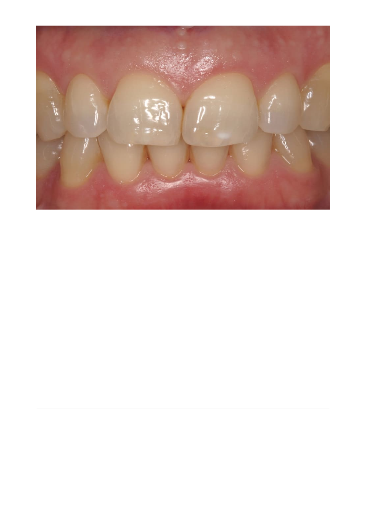 Grátis: 15 Problemas de saúde bucal mais comum e como tratar - Material  Claro e Objetivo em PDF para Estudo Rápido, image size:1190x1684