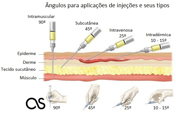tipos injecoes - Fundamentos