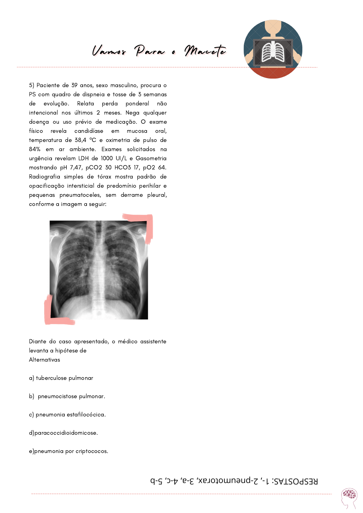 Descomplicando o raio x de tórax - Estudos de Exames por Imagem