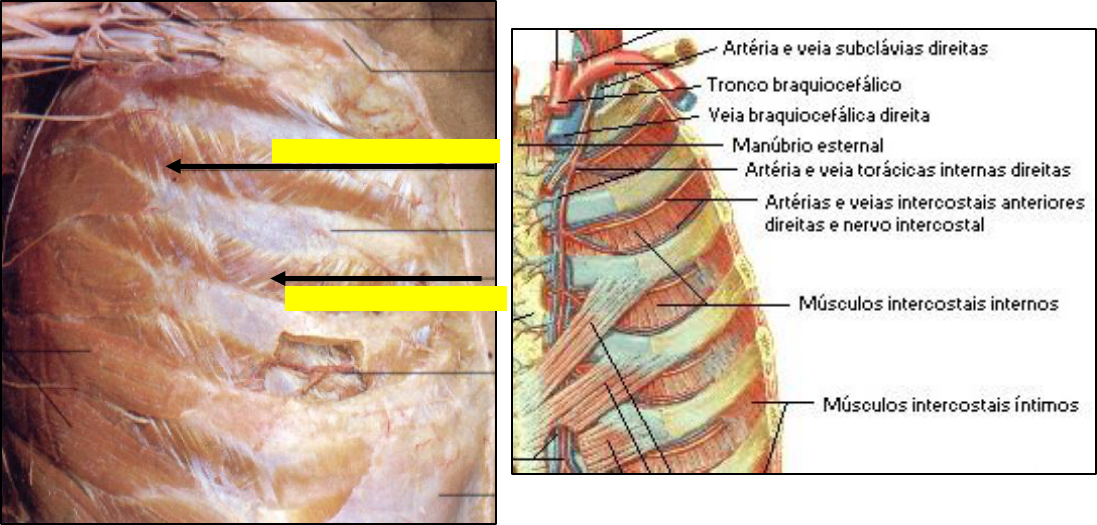 cadáver de músculo intercostal externo
