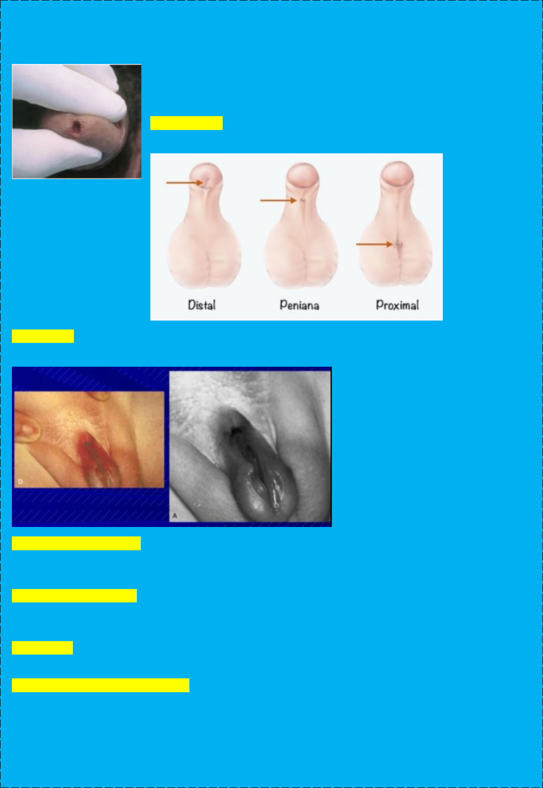 SISTEMA GENITAL MASCULINO - Habilidades Médicas