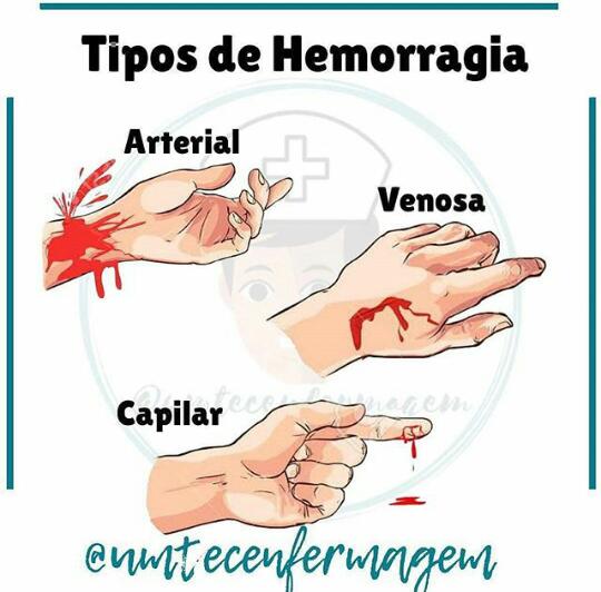 Tipos De Hemorragia Anatomia I