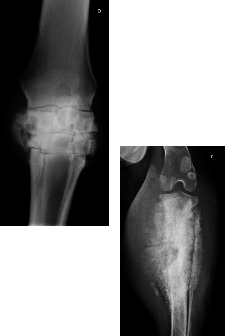 Tratamento da epicondilite lateral (cotovelo de babá) | Cuidados  pediátricos seguros e eficazes, image size:743x1106