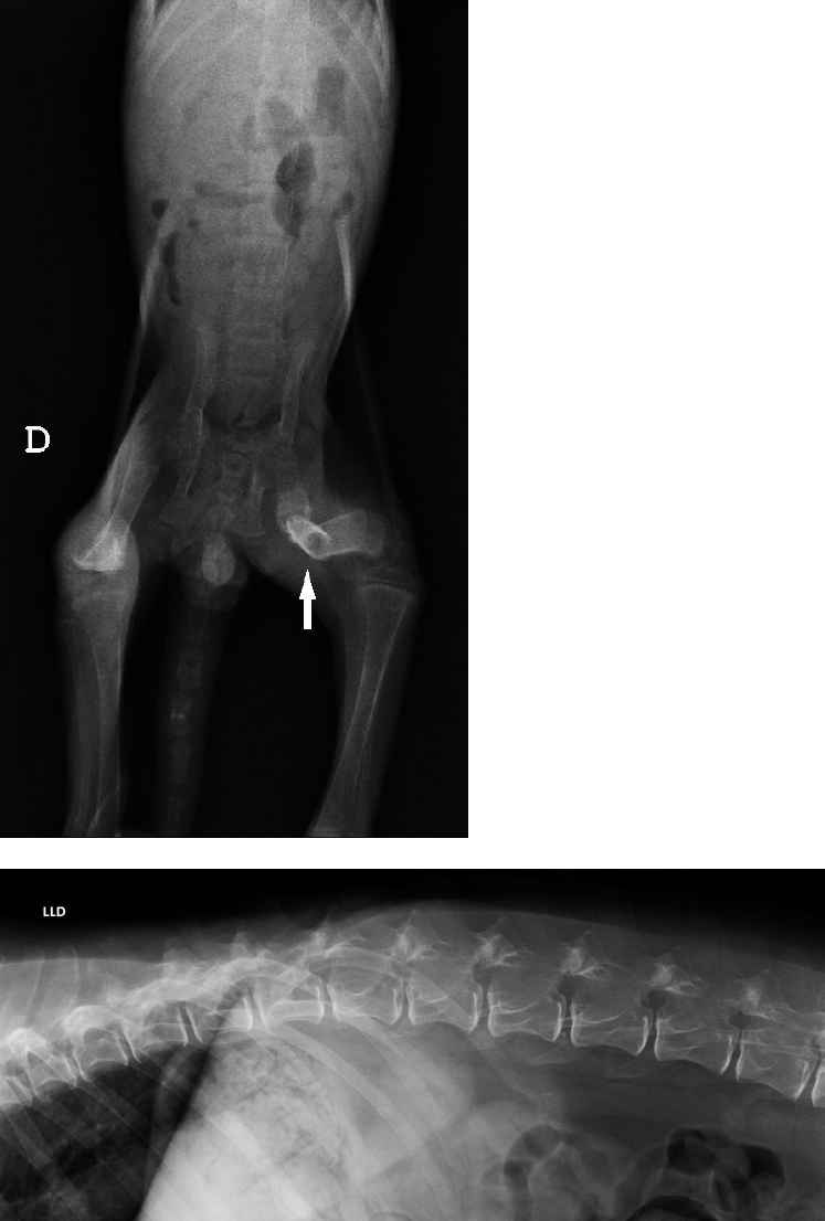 Visão Lateral Do Crânio De Radiografia De Filme Mostra Crânio Humano Normal  E Coluna Cervical E área Em Branco No Lado Esquerdo Foto E Imagem Para  Download Gratuito - Pngtree, image size:747x1106