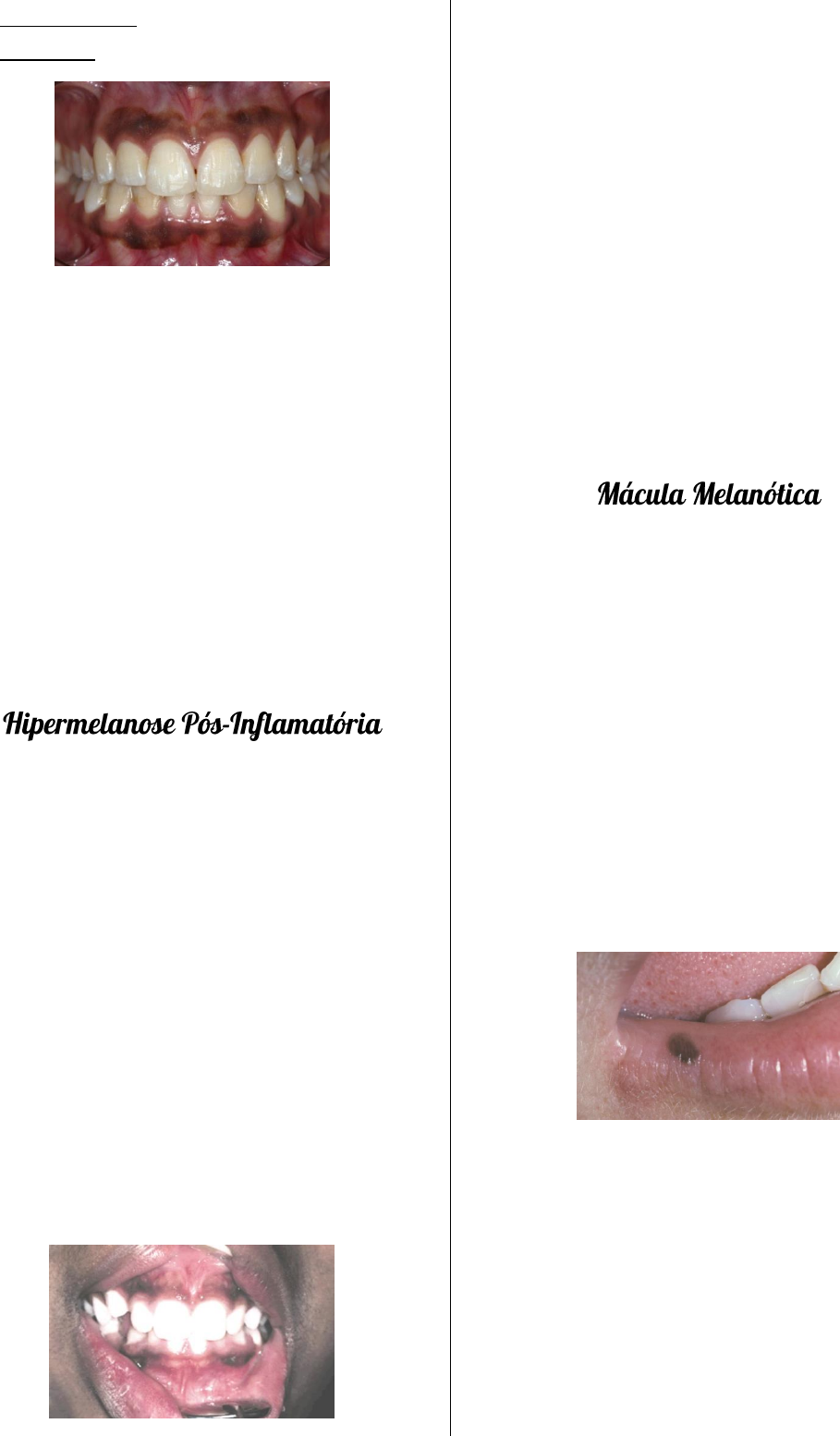 tempo de cicatrizao exciso mcula melantica lbio inferior com pontos labial: diagnstico, diferenciais e condutas clnicas Manchas Escuras nos Lbios: O