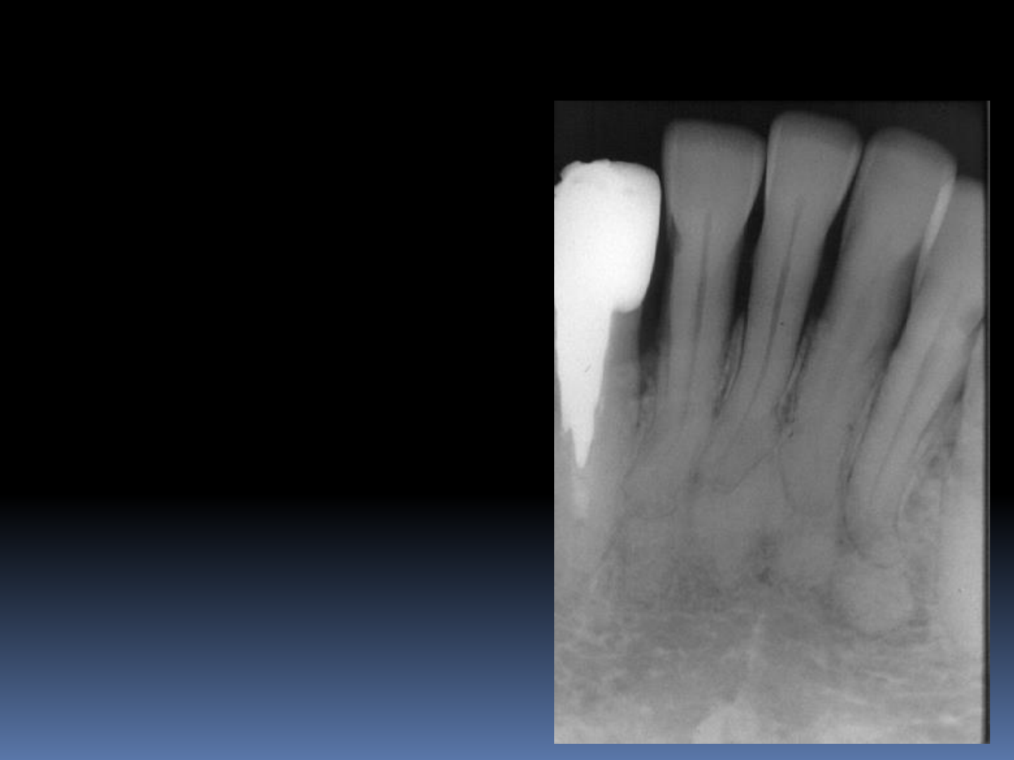 Patologias e Lesões Orais Comuns | PDF | Dente | Esmalte dentário, image size:1440x1080