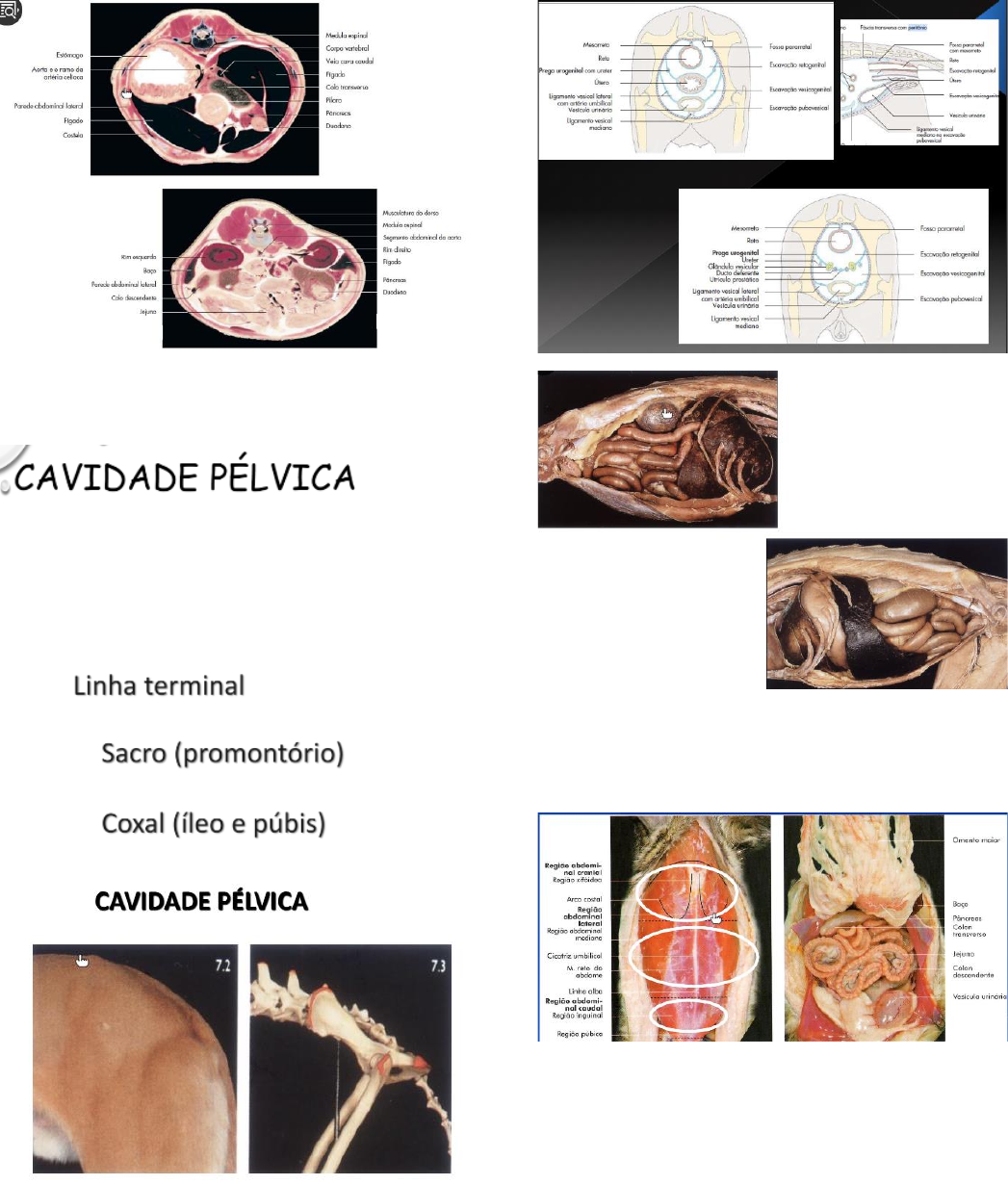 Grátis: Cavidade abdominal - Part 1 - Material Claro e Objetivo em PDF para  Estudo Rápido, image size:1047x1231