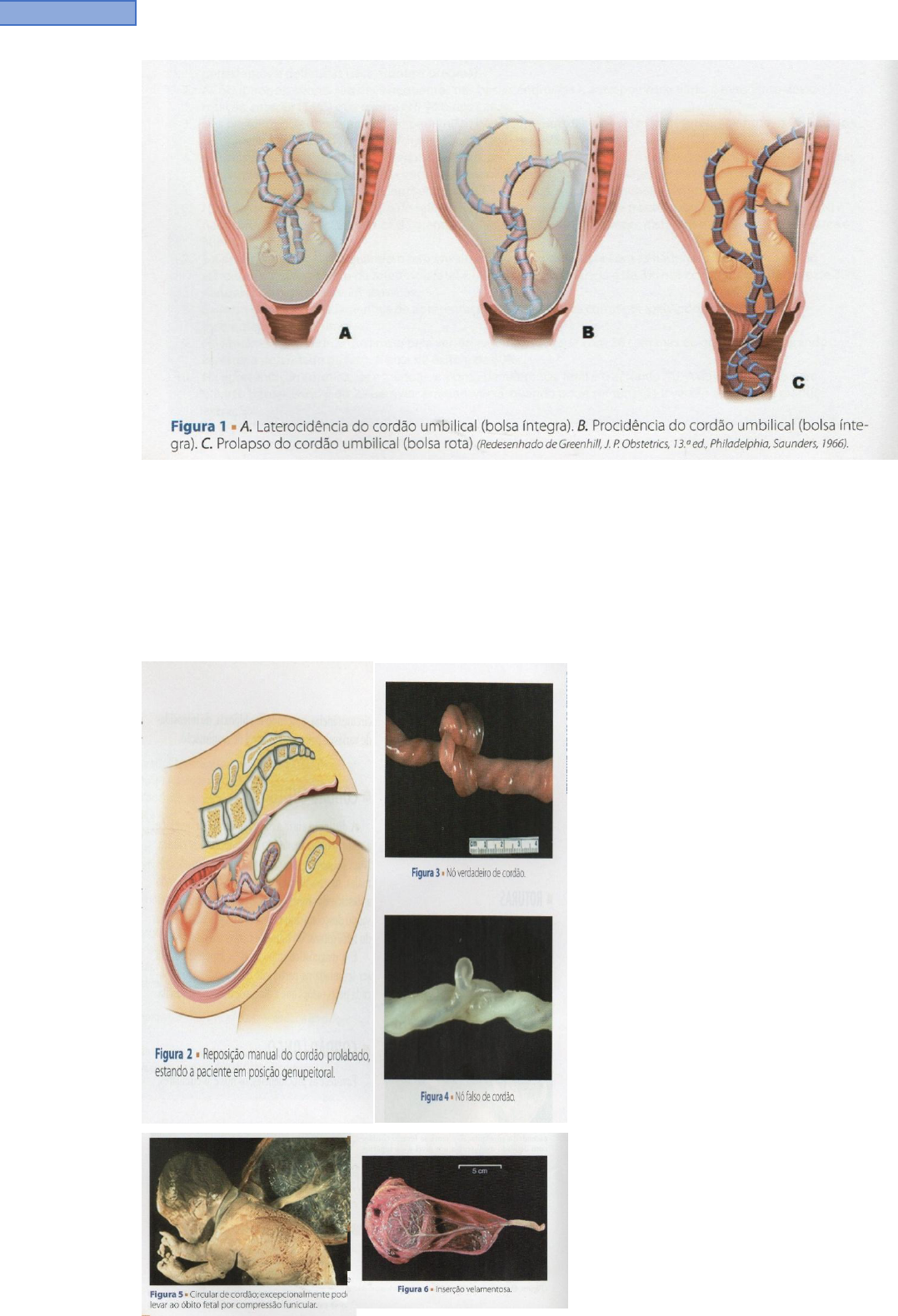 Grátis: sofrimento fetal agudo - Material Claro e Objetivo em PDF para  Estudo Rápido, image size:1078x1580