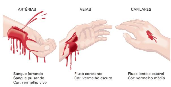 Primeiros Socorros Hemorragia E Choques Primeiros Socorros