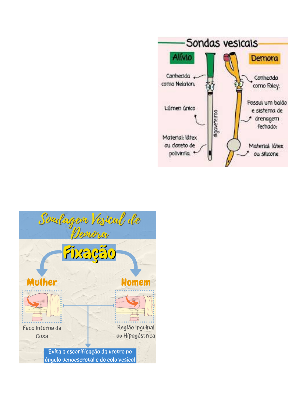 Grátis: Sondagem Vesical - Material Claro e Objetivo em PDF para Estudo  Rápido