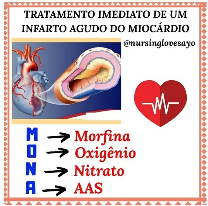 Tratamento Imediato De Um Infarto Agudo Do Miocárdio Resumo Geral