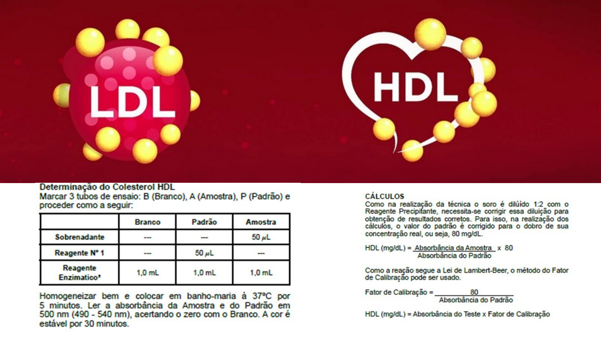 HDL Cholesterol: 38 mg/dL