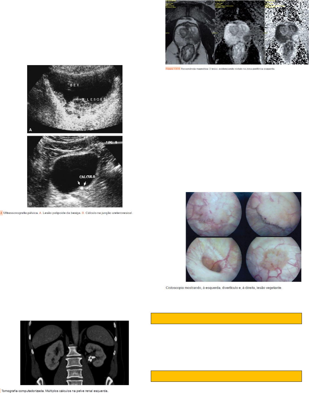 Grátis: 4 Semio Genital Masculino - Material Claro e Objetivo em PDF para  Estudo Rápido