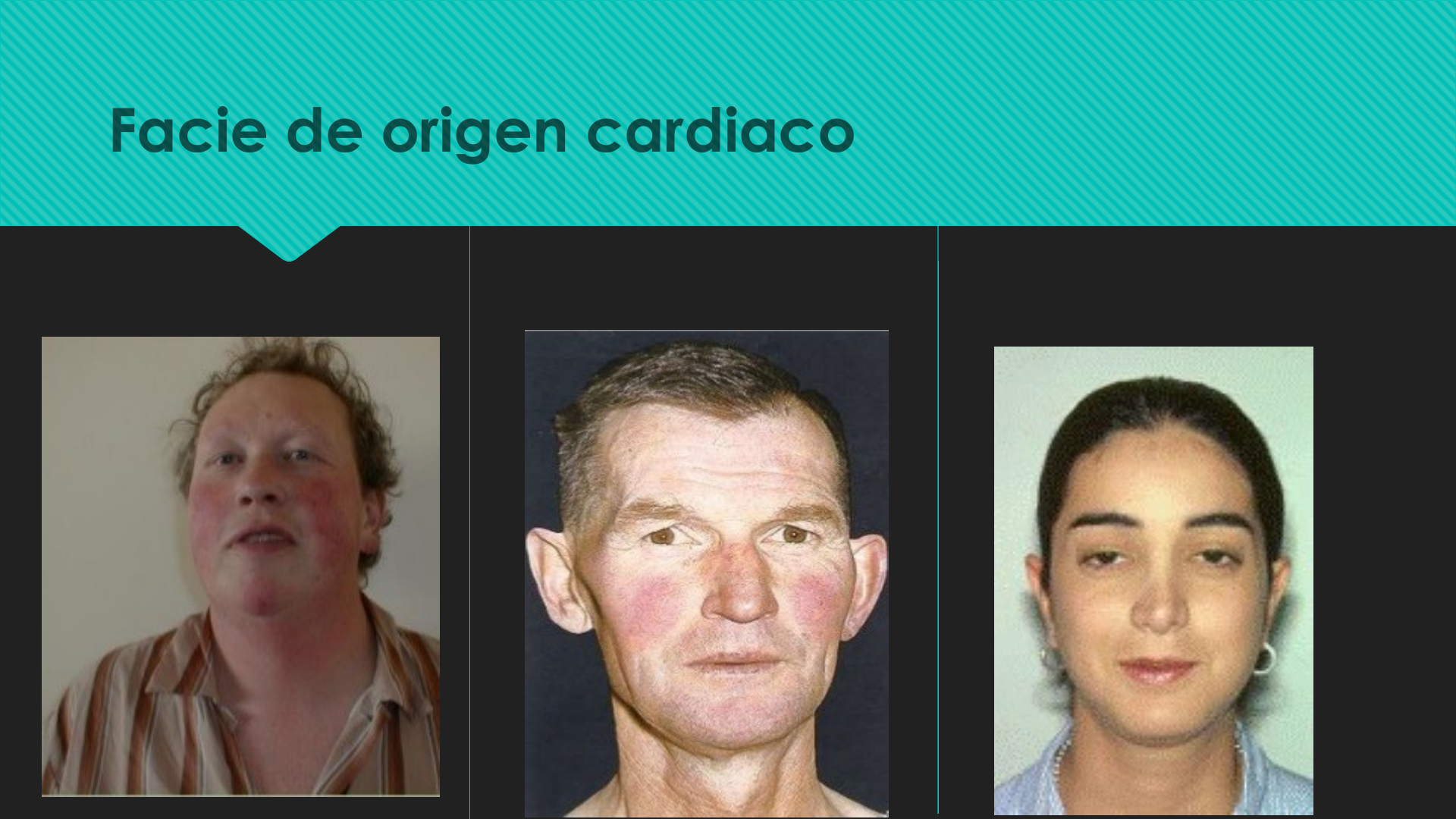 Adenoids | PPTX, image size:1920x1080