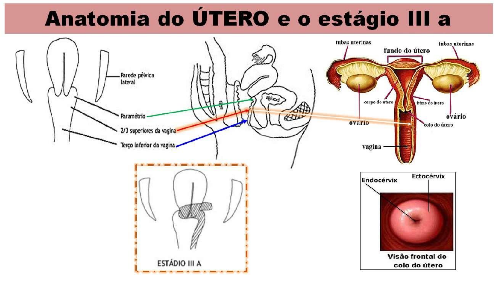 ooforectomia  Dicionário Infopédia de Termos Médicos