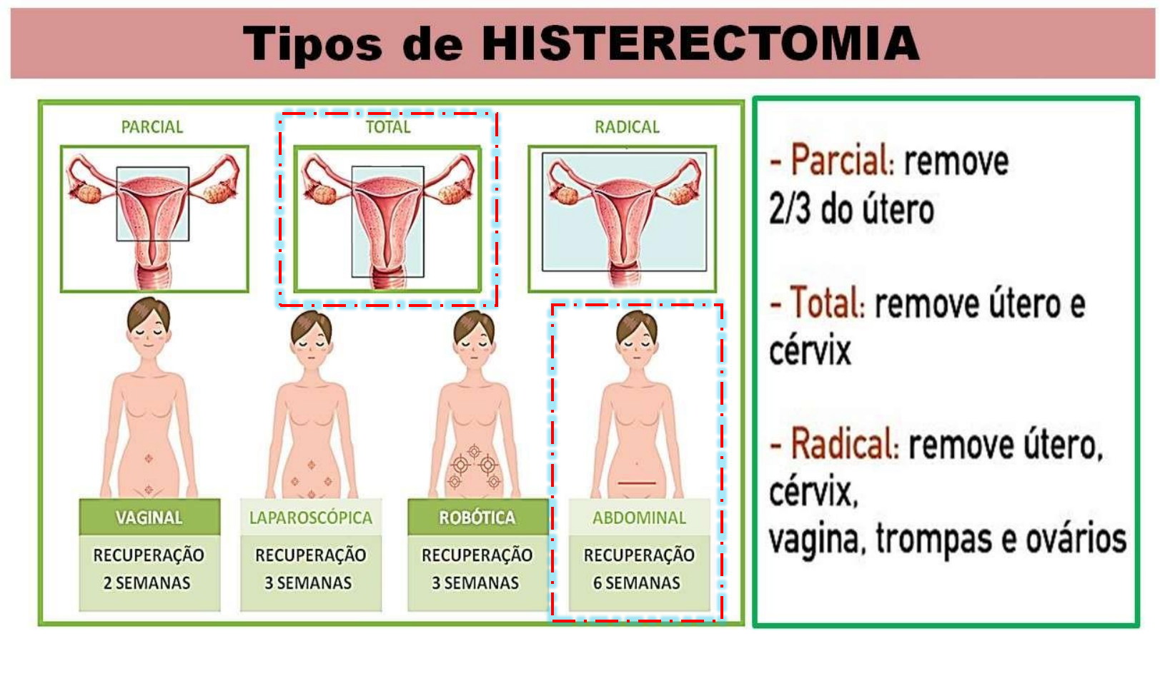 ooforectomia  Dicionário Infopédia de Termos Médicos