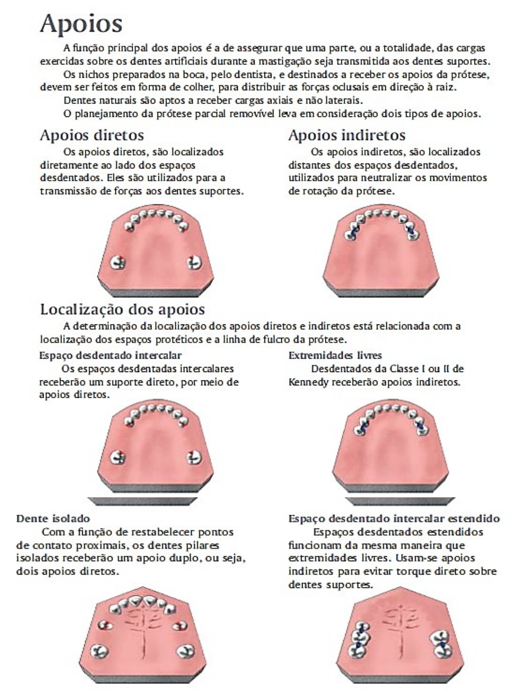 Tipos De Grampos Em Ppr Braincp