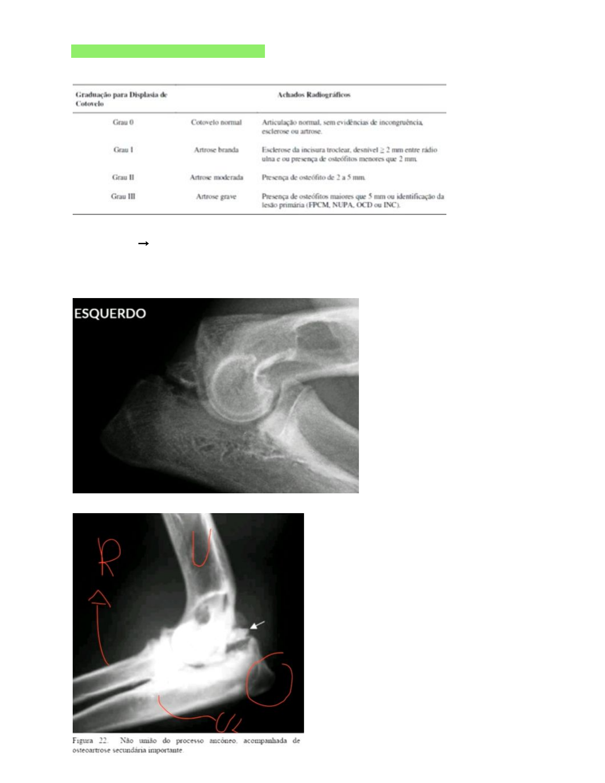 Radiografia do Antebraço - AP e Perfil, image size:1224x1584