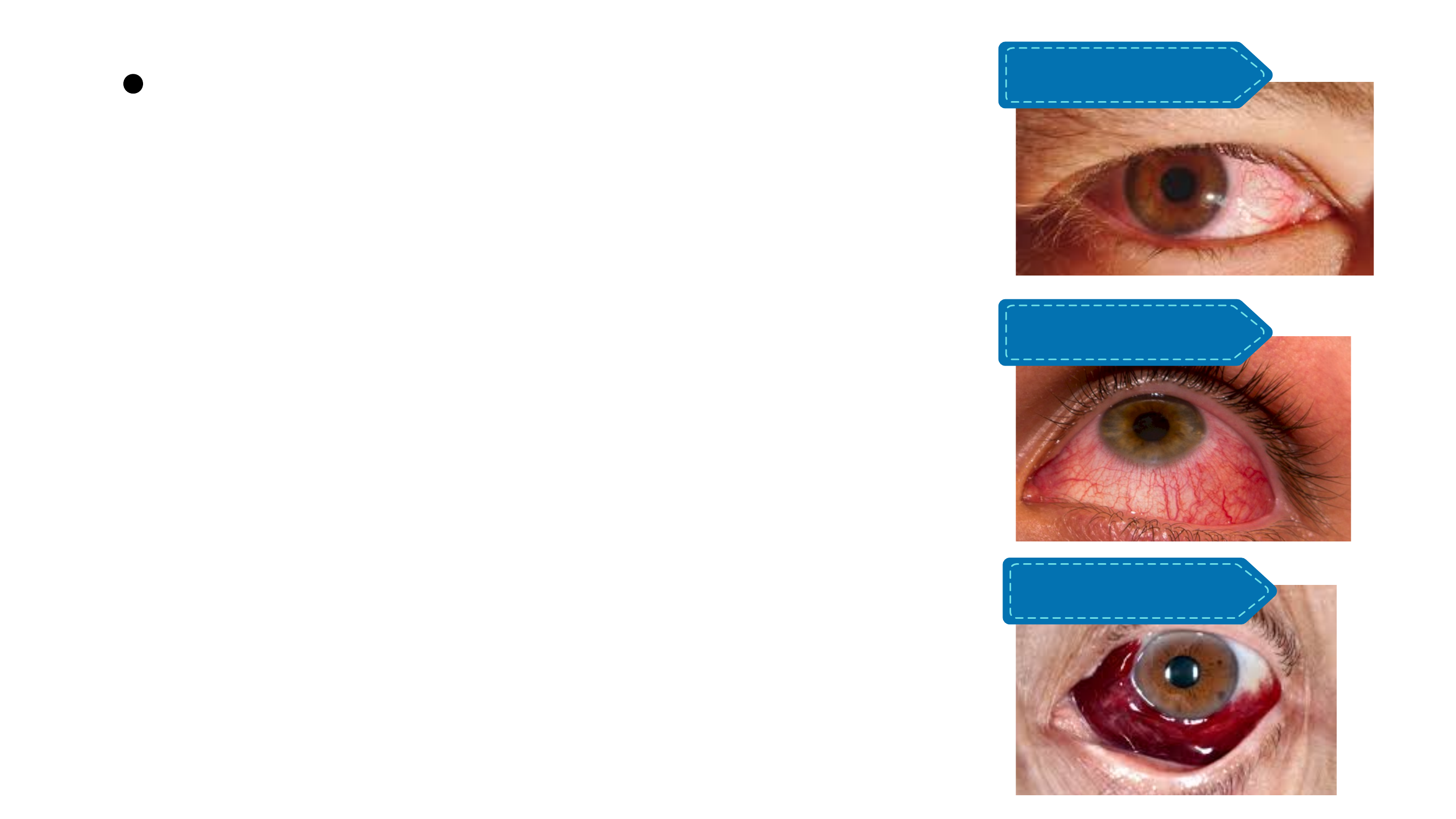 Grátis: Resumo de Oftalmologia e Otorrinolaringologia - Material Claro e  Objetivo em PDF para Estudo Rápido, image size:2880x1620