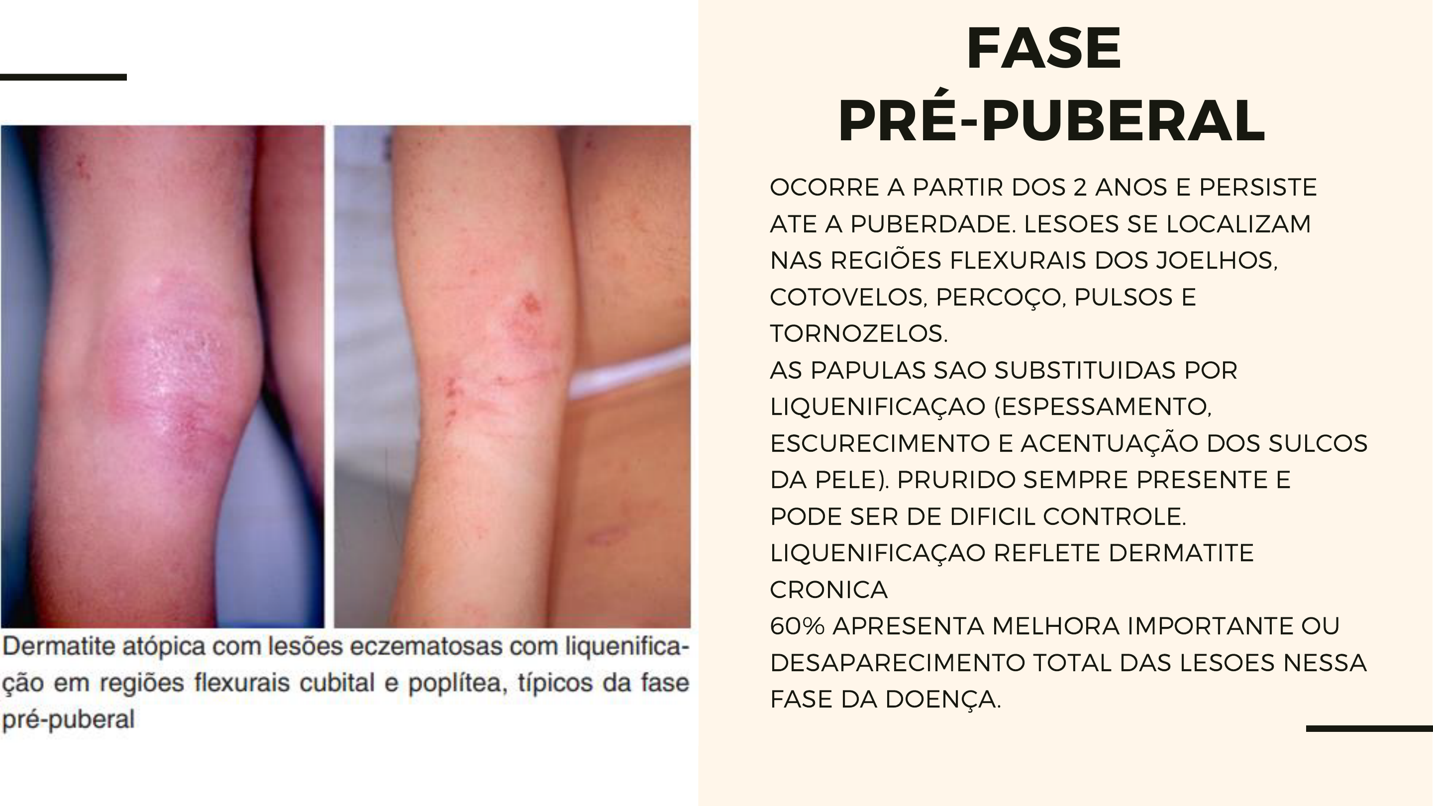 Grátis: DERMATITE ATOPICA - Material Claro e Objetivo em PDF para Estudo  Rápido, image size:2880x1620