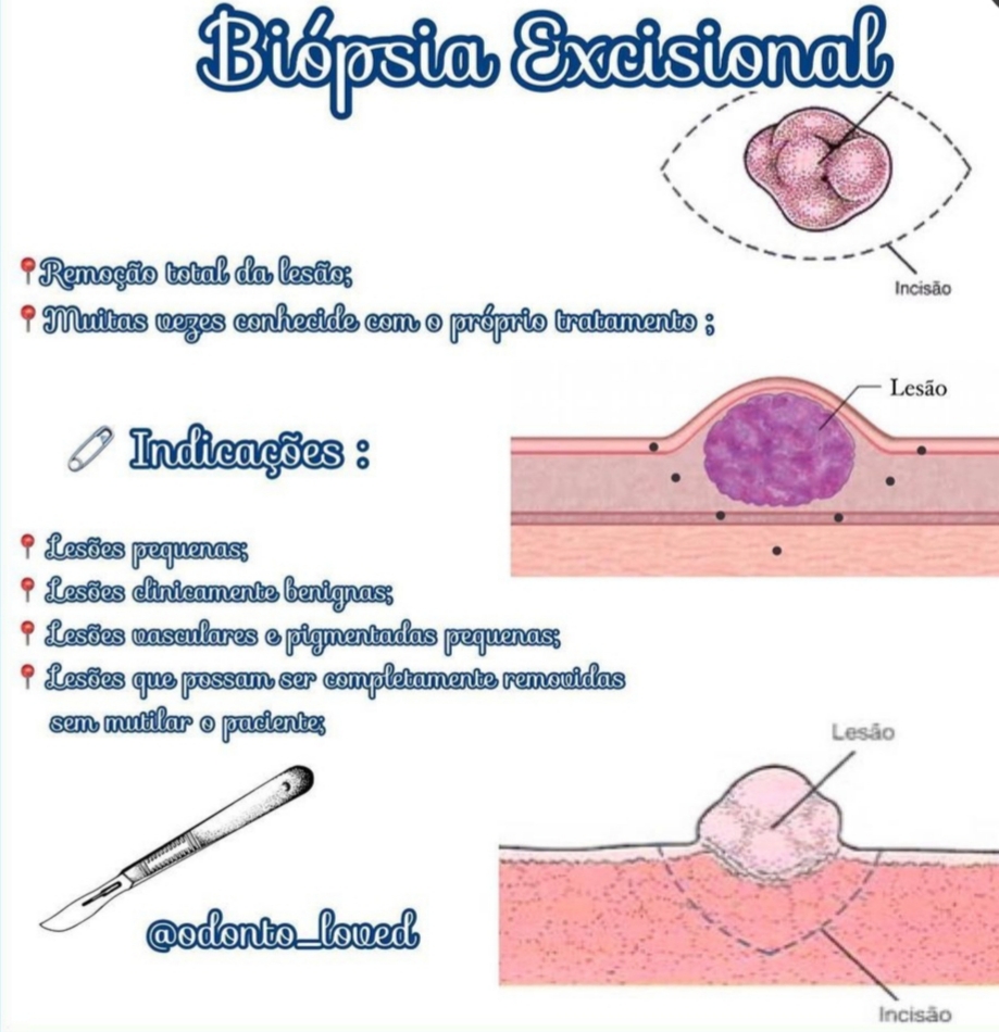 Biopsia Excisional E Incisional Edulearn 