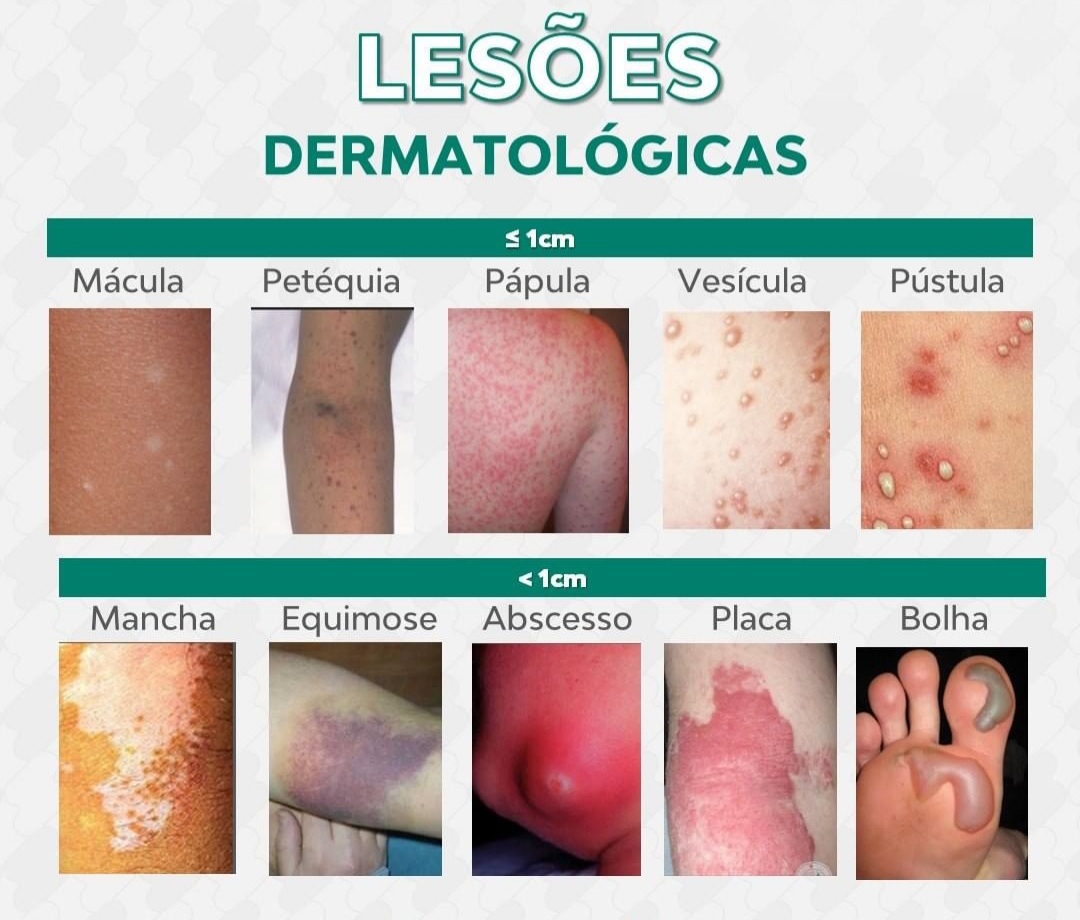 Lesões Dermatológicas Enfermagem 6614