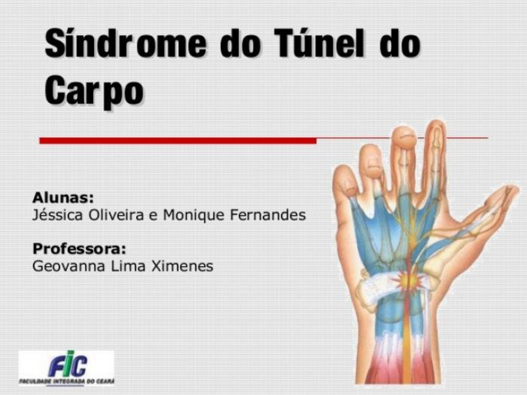 Sindrome do tunel do carpo (1) Traumatologia e Ortopedia Sindrome do tunel do carpo (1) Traumatologia e Ortopedia