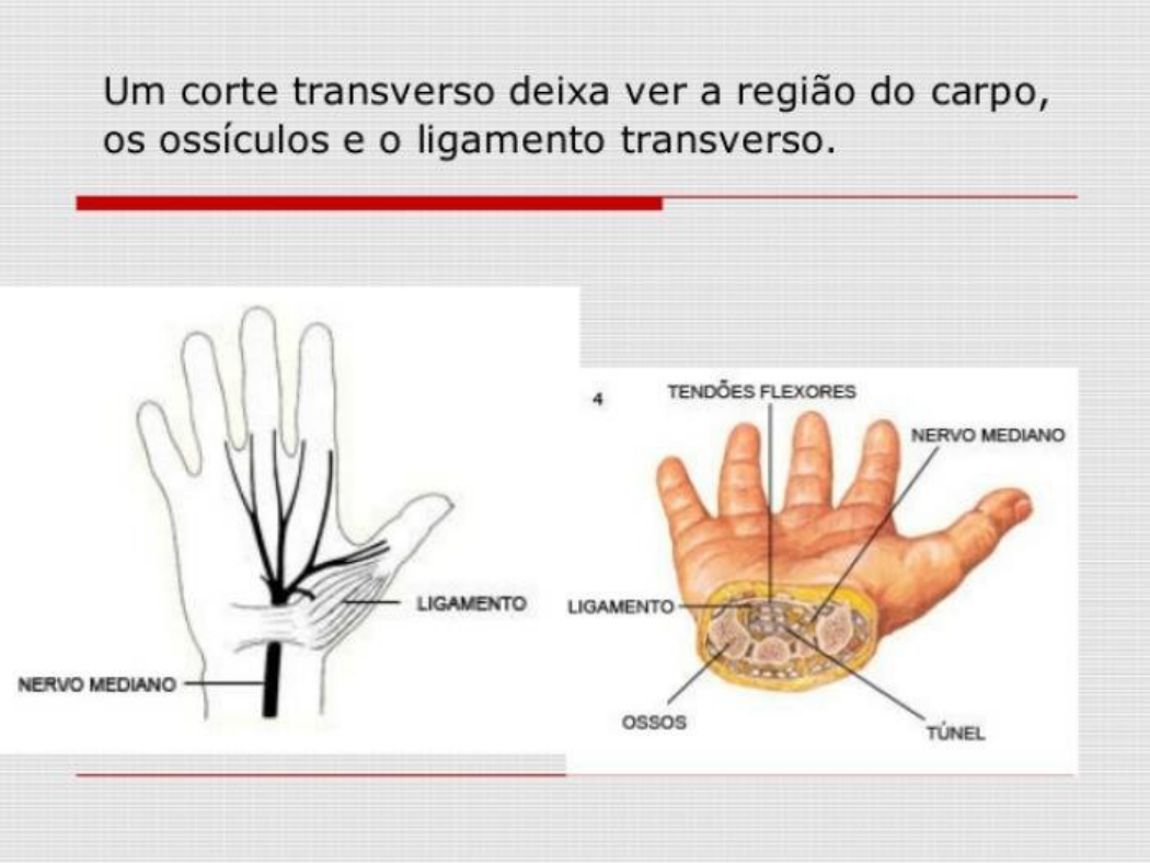 Sindrome do tunel do carpo (1) Traumatologia e Ortopedia Sindrome do tunel do carpo (1) Traumatologia e Ortopedia