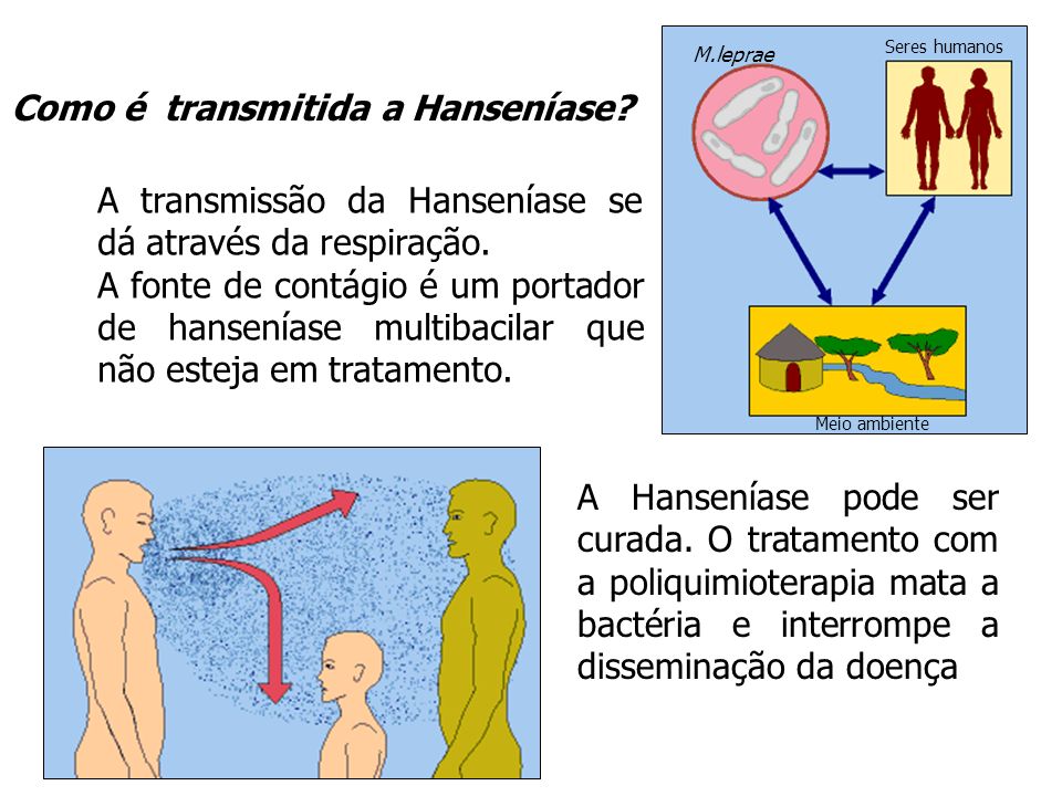 Comoétransmitidaahanseníase Enfermagem Em Saúde Da Família 8685