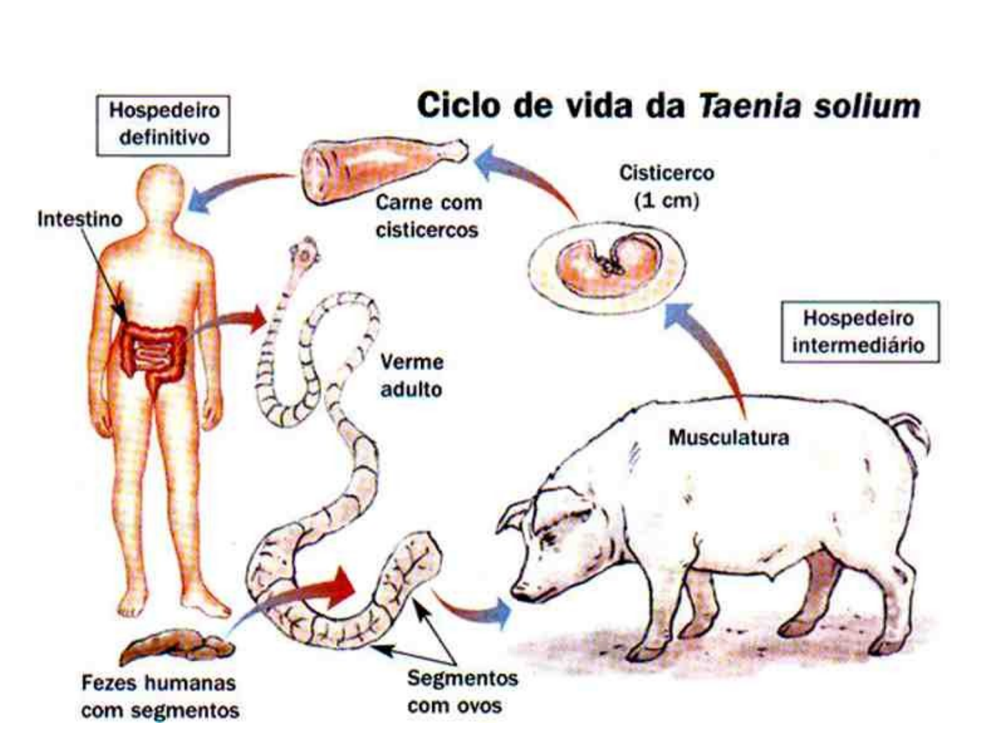 Um homem foi ao seu médico por causa de dores de estômago e coceira na pele  😟 Raio-X mostraram que todo o seu corpo estava infectado com vermes (eu  tinha). Os médicos, image size:1440x1080