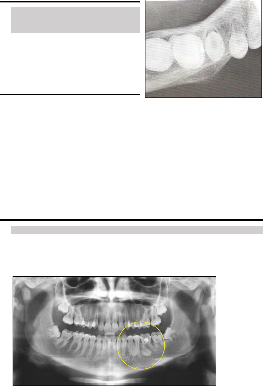 Doenças Periapicais Inflamatórias (Agudas E Cronicas) | Joice Carla | Quizur, image size:857x1259