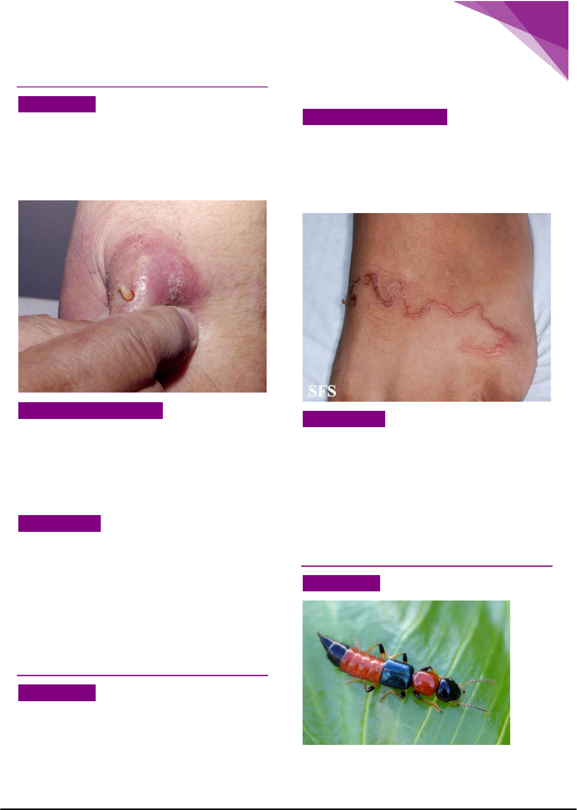 Picadas de insetos na mão feminina — Foto © toxawww #233554440, image size:1134x1593