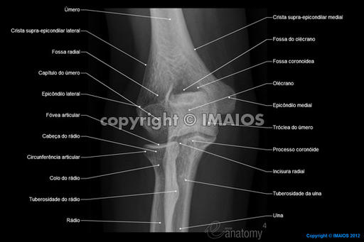 radiografia-de-anatomia-do-cotovelo-radiografia-em-perfil-do-cotovelo
