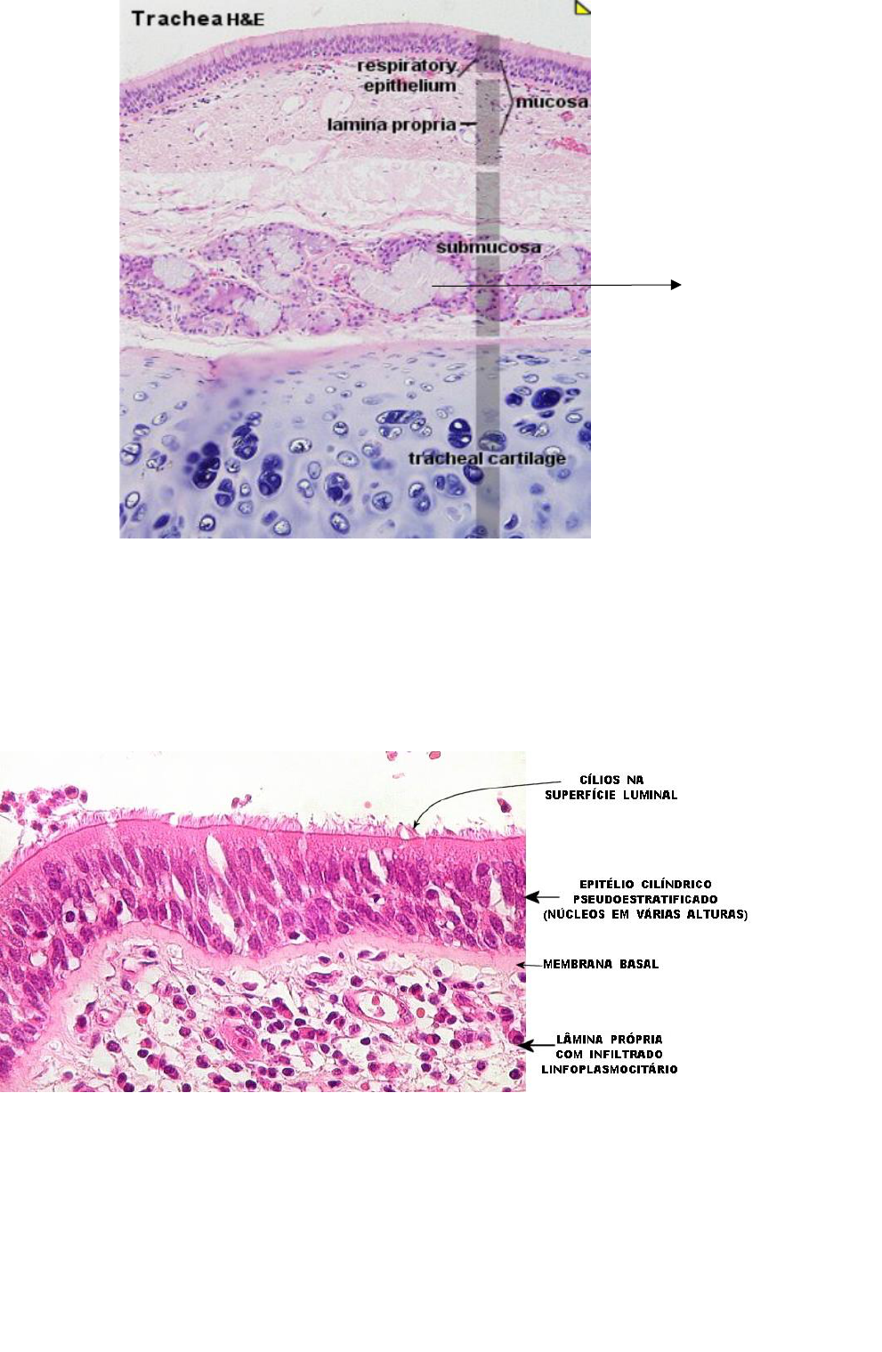 Histologia Da Traqueia E Do Esofago