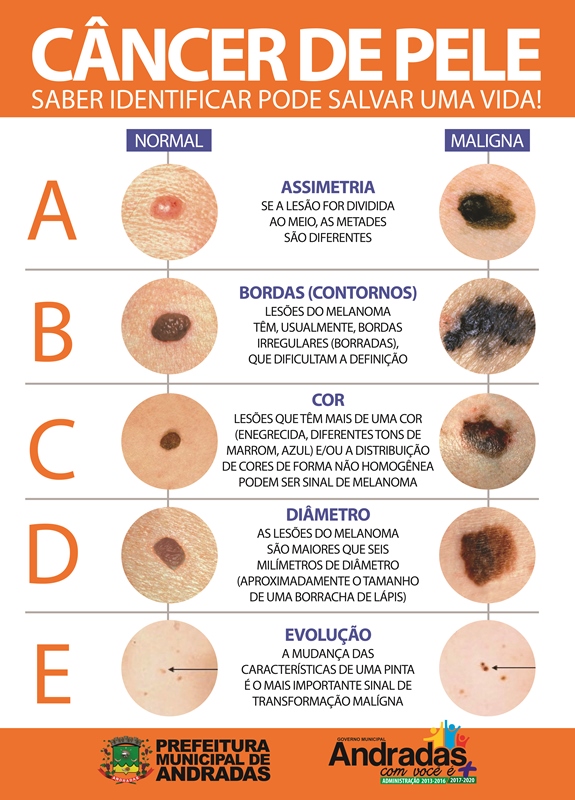 CARTAZ CANCER DE PELE Cosmetologia