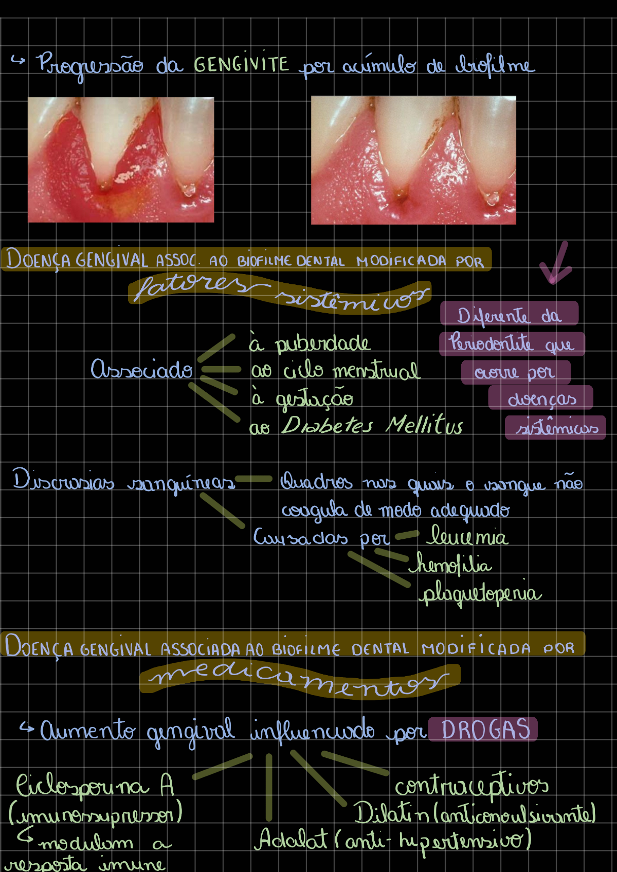 Classificacao Das Doencas Periodontais - Periodontia