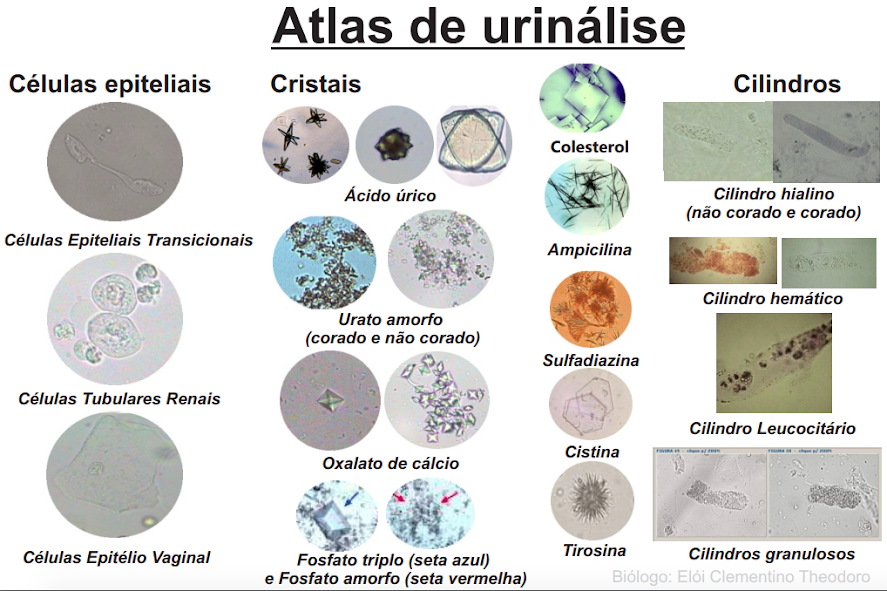 Atlas De Urinálise 2 3 - Urianalise