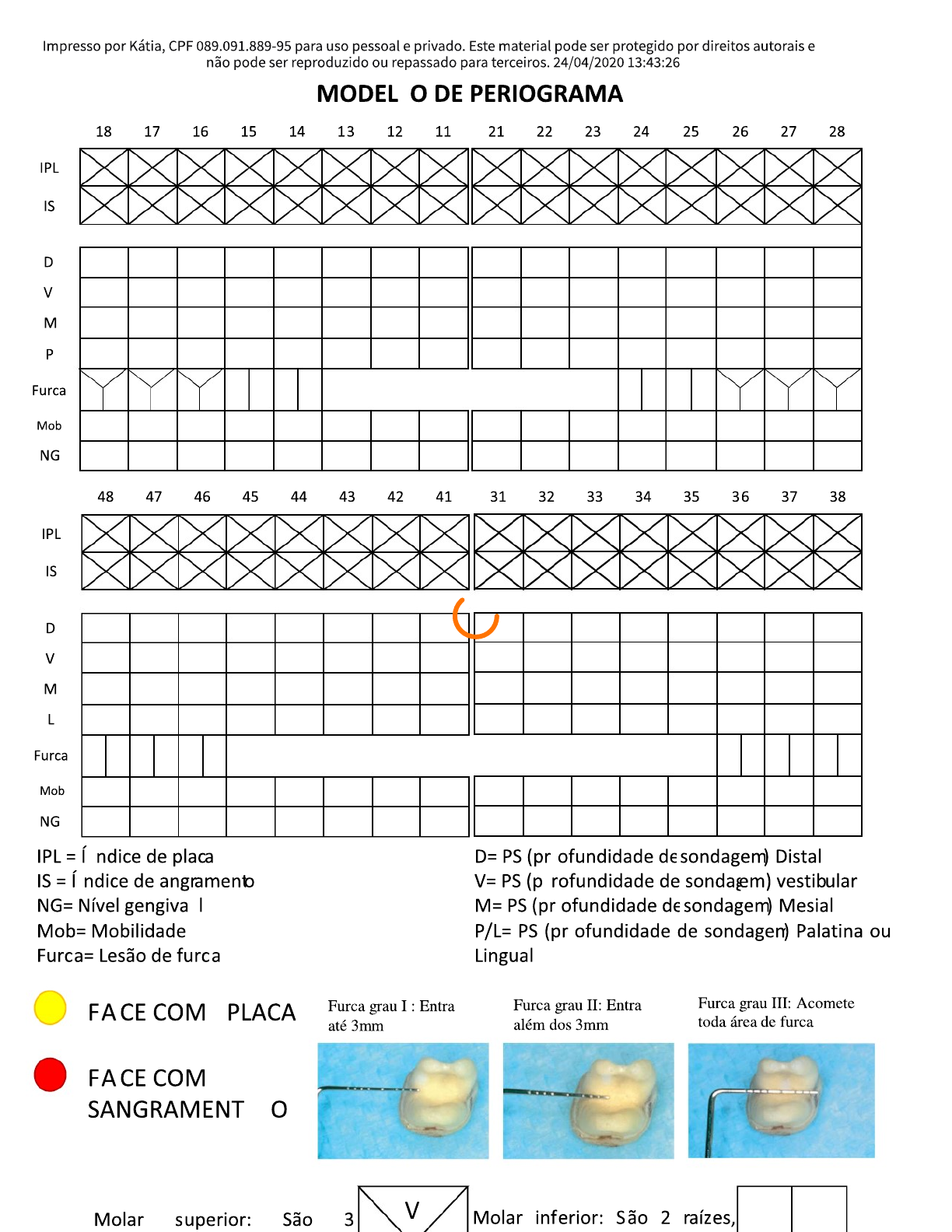 Exercicios Para Classificação - Periodontia